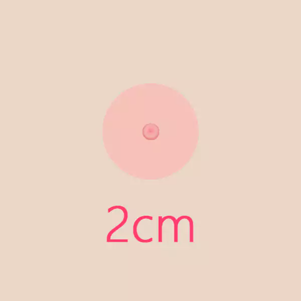 2cm