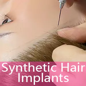 Synthetic Hair Implants (-50% Off)